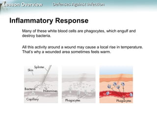 Lesson Overview

Defenses Against Infection

Inflammatory Response
Many of these white blood cells are phagocytes, which engulf and
destroy bacteria.
All this activity around a wound may cause a local rise in temperature.
That’s why a wounded area sometimes feels warm.

 