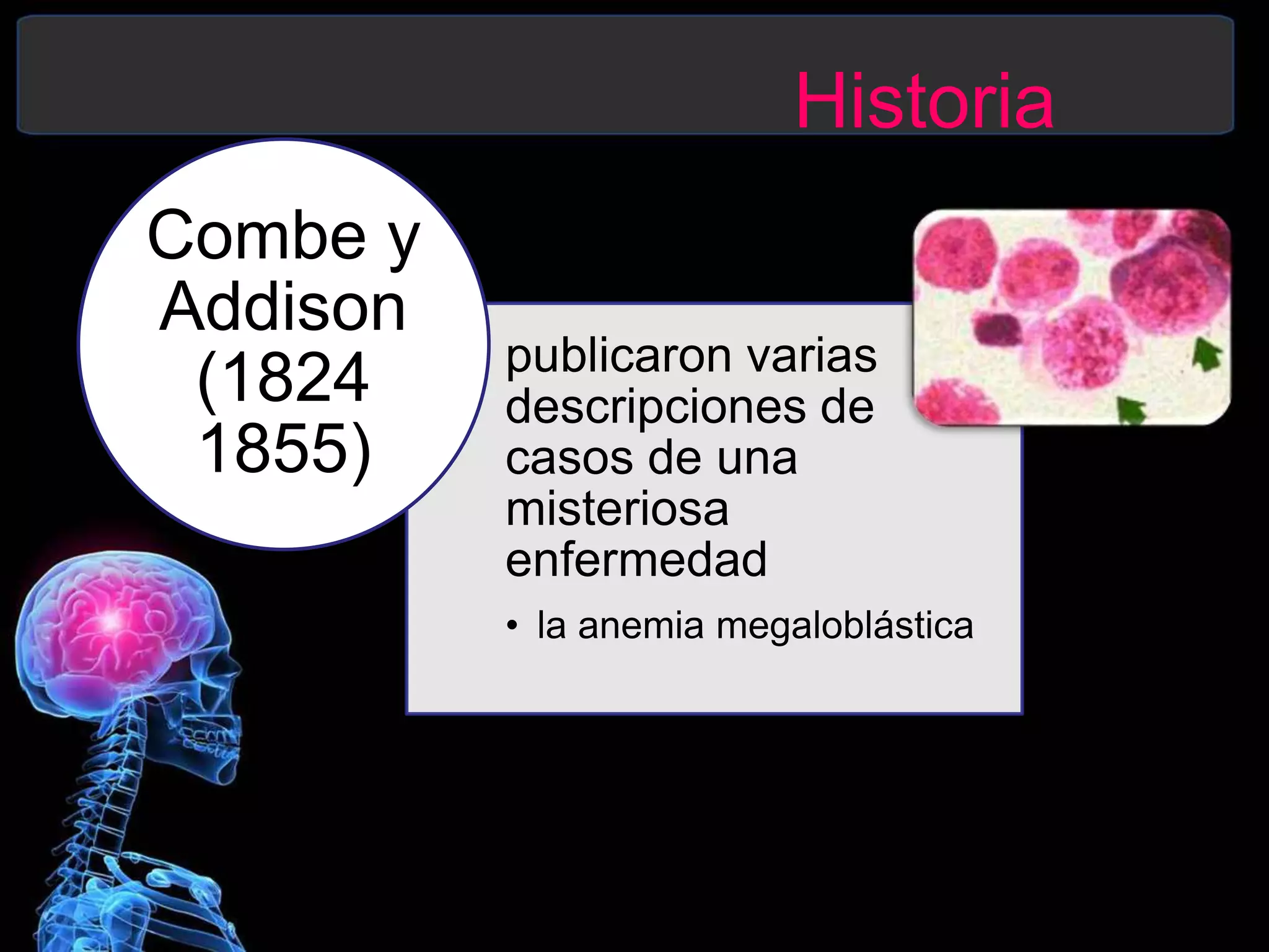 Historia
publicaron varias
descripciones de
casos de una
misteriosa
enfermedad
• la anemia megaloblástica
Combe y
Addison
(1824
1855)
 