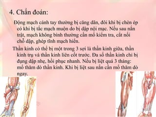 4. Chẩn đoán:
Động mạch cánh tay thường bị căng dãn, đôi khi bị chèn ép
có khi bị tắc mạch muộn do bị dập nội mạc. Nếu sau nắn
trật, mạch không bình thường cần mổ kiểm tra, cắt nối
chỗ dập, ghép tĩnh mạch hiển.
Thần kinh có thể bị một trong 3 sợi là thần kinh giữa, thần
kinh trụ và thần kinh liên cốt trước. Đa số thần kinh chỉ bị
đụng dập nhẹ, hồi phục nhanh. Nếu bị liệt quá 3 tháng:
mổ thăm dò thần kinh. Khi bị liệt sau nắn cần mổ thăm dò
ngay.

 