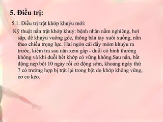 5. Điều trị:
5.1. Điều trị trật khớp khuỷu mới:
Kỹ thuật nắn trật khớp khuỷ: bệnh nhân nằm nghiêng, hơi
sấp, để khuỷu vuông góc, thõng bàn tay xuôi xuống, nắn
theo chiều trọng lực. Hai ngón cái đẩy mỏm khuỷu ra
trước, kiểm tra sau nắn xem gấp - duỗi có bình thường
không và khi duỗi hết khớp có vững không.Sau nắn, bất
động nẹp bột 10 ngày rồi cử động sớm, khoảng ngày thứ
7 có trường hợp bị trật lại trong bột do khớp không vững,
cơ co kéo.

 