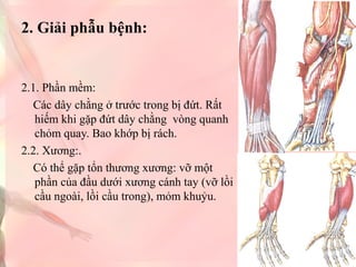 2. Giải phẫu bệnh:

2.1. Phần mềm:
Các dây chằng ở trước trong bị đứt. Rất
hiếm khi gặp đứt dây chằng vòng quanh
chỏm quay. Bao khớp bị rách.
2.2. Xương:.
Có thể gặp tổn thương xương: vỡ một
phần của đầu dưới xương cánh tay (vỡ lồi
cầu ngoài, lồi cầu trong), mỏm khuỷu.

 