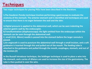 Techniques
Two major techniques for placing PEGs have been described in the literature.
1,The Gauderer-Ponsky technique involves performing a gastroscopy to evaluate the
anatomy of the stomach. The anterior stomach wall is identified and techniques are used
to ensure that there is no organ between the wall and the skin:
A,Digital pressure is applied to the abdominal wall, which can be seen indenting the
anterior gastric wall by the endoscopist.
B,Transillumination (diaphanoscopy): the light emitted from the endoscope within the
stomach can be seen through the abdominal wall.
C, small (21G, 40mm) needle is passed into the stomach before the larger cannula is
passed.
2,An angiocath is used to puncture the abdominal wall through a small incision, and a soft
guidewire is inserted through this and pulled out of the mouth. The feeding tube is
attached to the guidewire and pulled through the mouth, esophagus, stomach, and out of
the incision.[2]
In the Russell introducer technique, the Seldinger technique is used to place a wire into
the stomach, and a series of dilators are used to increase the size of the gastrostomy. The
tube is then pushed in over the wire.
 