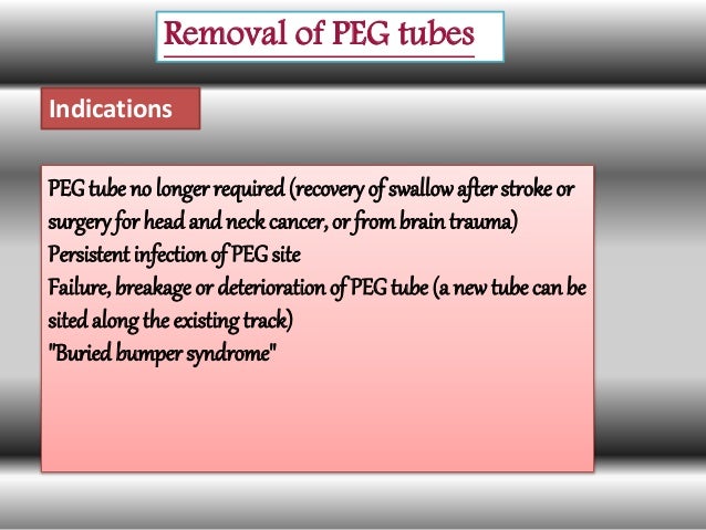 percutaneous endoscopic gastrostomy peg The ins & outs of gastrostomy tubes feasibiity of the cut-and-push method for removing large-caliber soft percutaneous endoscopic gastrostomy devices. percutaneous endoscopic gastrostomy peg The ins & outs of gastrostomy tubes feasibiity of the cut-and-push method for removing large-caliber soft percutaneous endoscopic gastrostomy devices.
