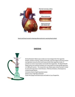 Heart and heart vessels showing atherosclerosis causing Heart attack.
SHEESHA
Shisha/Hookah/Waterpipe smoke are more dangerthenthe cigarette
Smoke,containsnicotine, carbonmonoxide,andcarcinogensandmaycontain
evengreateramountsof tar and heavymetalsthancigarette smoke.It
contains11 timesmore Carbonmonoxide thanCigarettes. The WorldHealth
Organizationhassaidthat hookahuse isequivalenttosmoking100 cigarettes
ina 200-puff session. The researcherssay,Waterpipe smoke hasbeenlinked
to oral andlungcancer, heartdisease,infectiousdiseases,and pregnancy-
relatedcomplications.
Increaseschance of gettingtuberculosis
Darkenslips,fingertipsandteeth
Coats the tongue andtaste buds andleadsto lossof appetite.
 
