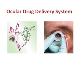 Ocular Drug Delivery System
 