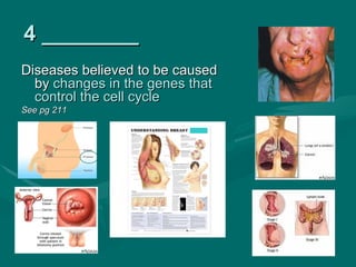 4 ________
Diseases believed to be caused
  by changes in the genes that
  control the cell cycle
See pg 211
 