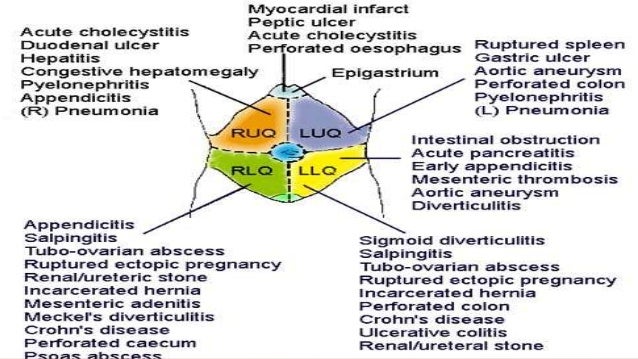 Acute Abdomen Ppt