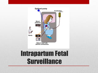 Intrapartum Fetal 
Surveillance 
 