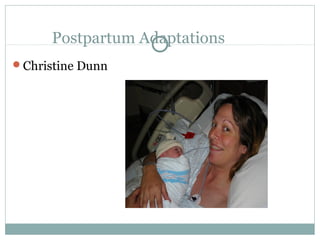 Postpartum Adaptations 
Christine Dunn 
 