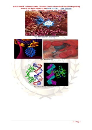 Ashish Dadhich, Gurudutt Sharma, Devendra Kumar / International Journal of Engineering
          Research and Applications (IJERA) ISSN: 2248-9622 www.ijera.com
                 Vol. 2, Issue 6, November- December 2012, pp.007-011




                           Fig.3: Nanodiamond in cancer treatment




                                    Fig.4: Nanomedicine




                           Fig.5: Gene therapy with nanodiamond




                                                                            11 | P a g e
 