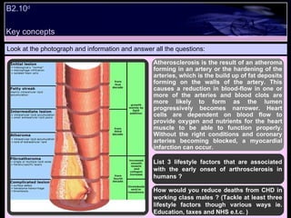 Key concepts B2.10 d   Look at the photograph and information and answer all the questions: Atherosclerosis is the result of an atheroma forming in an artery or the hardening of the arteries, which is the build up of fat deposits forming on the walls of the artery. This causes a reduction in blood-flow in one or more of the arteries and blood clots are more likely to form as the lumen progressively becomes narrower. Heart cells are dependent on blood flow to provide oxygen and nutrients for the heart muscle to be able to function properly. Without the right conditions and coronary arteries becoming blocked, a myocardial infarction can occur. List 3 lifestyle factors that are associated with the early onset of arthrosclerosis in humans ? How would you reduce deaths from CHD in working class males ? (Tackle at least three lifestyle factors though various ways ie. Education, taxes and NHS e.t.c. )  