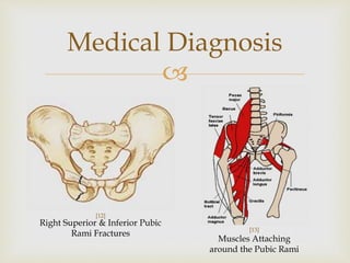 Adam Rami Muscles Clinical Correlates I Final Presentation | PPTX