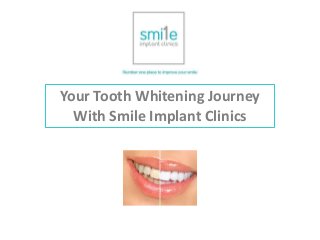 Your Tooth Whitening Journey
With Smile Implant Clinics
 