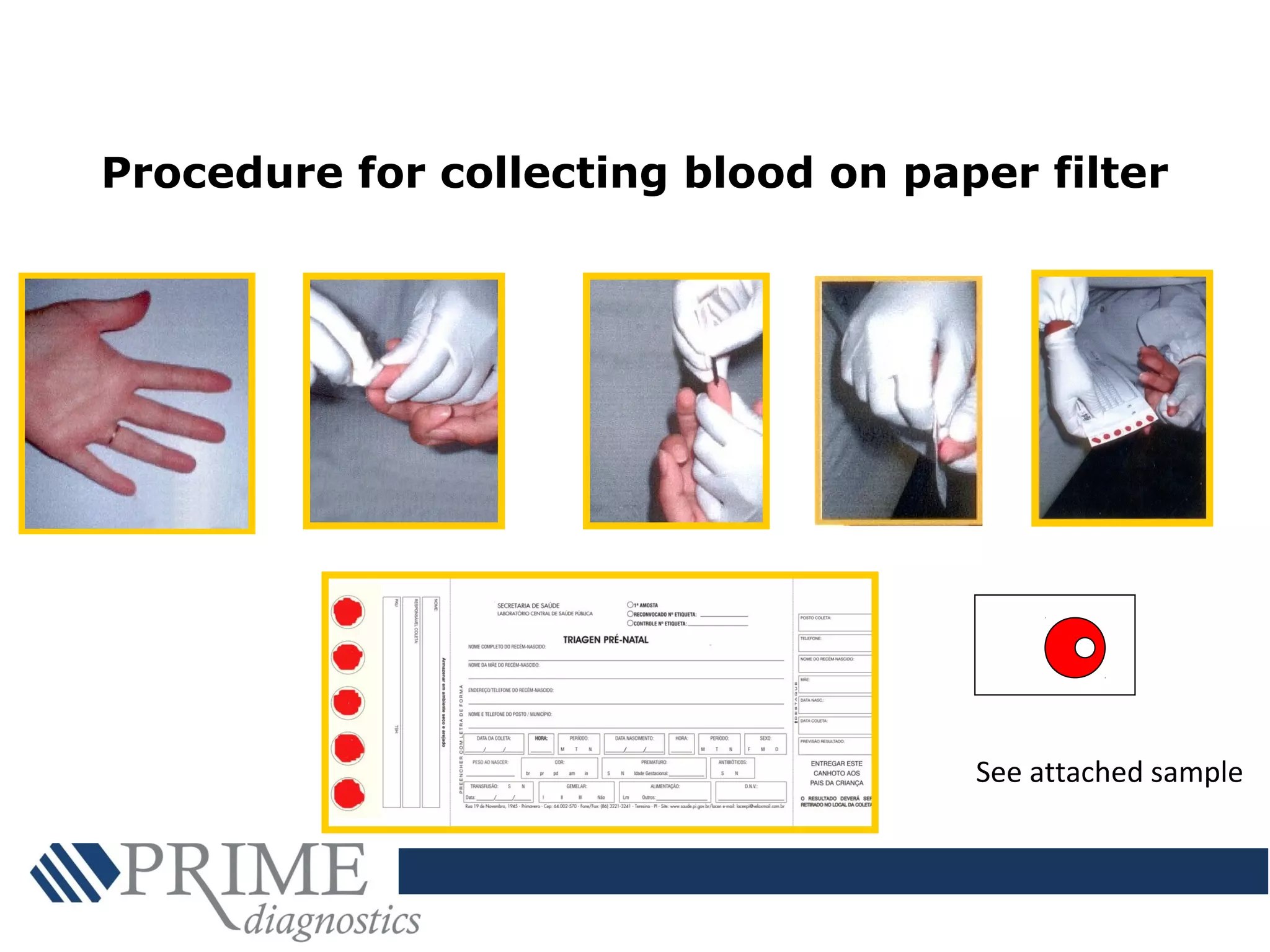 Procedure for collecting blood on paper filter
See attached sample
 