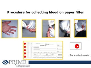 Procedure for collecting blood on paper filter
See attached sample
 