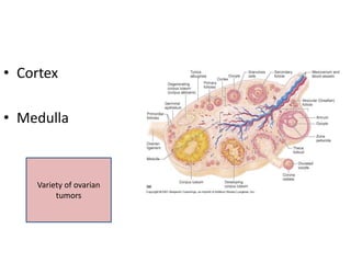 • Cortex
• Medulla
Variety of ovarian
tumors
 
