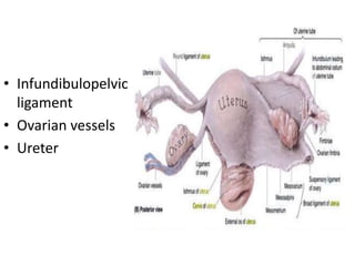 • Infundibulopelvic
ligament
• Ovarian vessels
• Ureter
 
