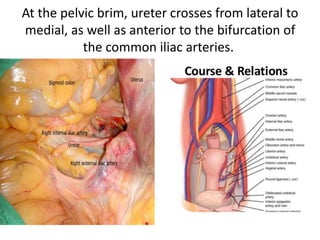 At the pelvic brim, ureter crosses from lateral to
medial, as well as anterior to the bifurcation of
the common iliac arteries.
 