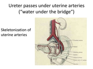 Ureter passes under uterine arteries
(“water under the bridge”)
Skeletonization of
uterine arteries
 
