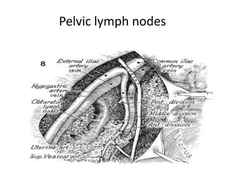Pelvic lymph nodes
 