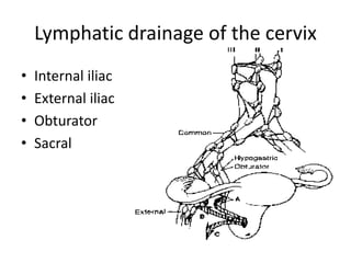 Lymphatic drainage of the cervix
• Internal iliac
• External iliac
• Obturator
• Sacral
 
