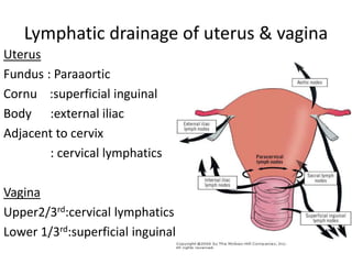Lymphatic drainage of uterus & vagina
Uterus
Fundus : Paraaortic
Cornu :superficial inguinal
Body :external iliac
Adjacent to cervix
: cervical lymphatics
Vagina
Upper2/3rd:cervical lymphatics
Lower 1/3rd:superficial inguinal
 