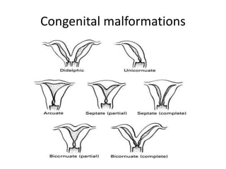 Congenital malformations
 
