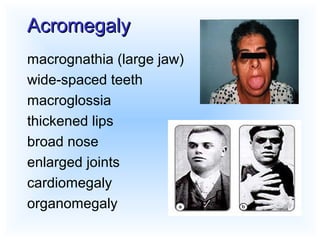 Endocrine drugs | PPT