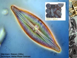Specimen: Diatom (100x)
Technique: Heine Phase Contrast 10/11
                        Nuno Correia    25
 