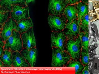 Specimen: Fibroblast microlayer microwound (400x)
Technique: Fluorescence Nuno Correia 10/11          30
 