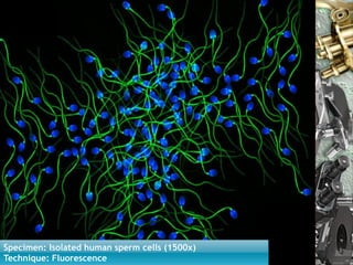 Specimen: Isolated human sperm cells (1500x)
Technique: Fluorescence Nuno Correia 10/11     31
 