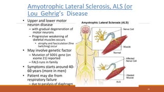 26
Amyotrophic Lateral Sclerosis, ALS (or
Lou Gehrig’s Disease
• Upper and lower motor
neuron disease
– with gradual degeneration of
motor neurons
– Progressive weakening of
skeletal muscles occurs
• atrophy and fasciculation (fine
twitching) occur
• May involve genetic factor
– Mutation of SOD1 gene (on
xsome 21) reported
– FALS runs in family
• Symptoms starts around 40-
60 years (more in men)
• Patient may die from
respiratory failure
– due to paralysis of diaphragm
 
