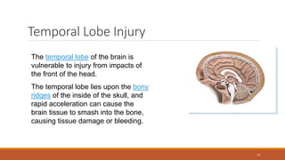 Temporal Lobe Injury
The temporal lobe of the brain is
vulnerable to injury from impacts of
the front of the head.
The temporal lobe lies upon the bony
ridges of the inside of the skull, and
rapid acceleration can cause the
brain tissue to smash into the bone,
causing tissue damage or bleeding.
73
 