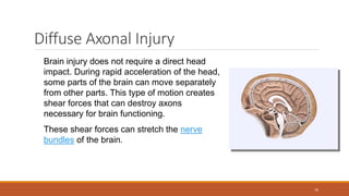 Diffuse Axonal Injury
Brain injury does not require a direct head
impact. During rapid acceleration of the head,
some parts of the brain can move separately
from other parts. This type of motion creates
shear forces that can destroy axons
necessary for brain functioning.
These shear forces can stretch the nerve
bundles of the brain.
76
 