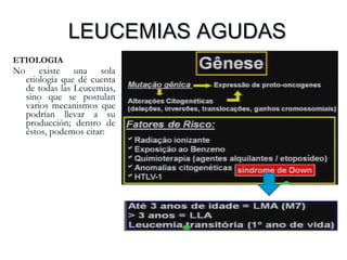 LEUCEMIAS AGUDASLEUCEMIAS AGUDAS
ETIOLOGIA
No existe una sola
etiología que dé cuenta
de todas las Leucemias,
sino que se postulan
varios mecanismos que
podrían llevar a su
producción; dentro de
éstos, podemos citar:
 