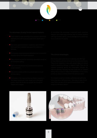 The advantages of using Precise’s tapered implants:
■ These implants enable penetration into locations with thicker
diameter and in soft tissue and softer bones (bone types III
and IV)
■ The narrow tapered implant is suitable for cases of limited
bone width and it prevents damage to the anatomical
structure
■ The implants enable reasonable alteration of the implantation
direction during the implant procedure
■ These implants are ideal for immediate implantation as well as
for immediate loading
■ They can be indicated for any condition, bone type and
surgical protocol
■ They promote bone condensing and provide enhanced
primary stability
■ The threads in the coronal portion are thicker trapezoid, in
the middle portion are thinner square and in the apical
portion, where the borders are straight, the threads are
sharper and V-shaped
To summarize, the advantages mentioned herein constitute
implants that enable easy insertion even to narrow locations
with high primary stability, prevent damage to the anatomical
structure and are self tapping.
The clinical advantages:
Our implants allow better bone condensing and oﬀer high
primary stability and minimum bone loss, thus reducing trauma.
They can be implanted in areas with narrow ridges and narrow
location, preventing damage to adjacent teeth. They can be
precisely controlled during the implantation through the
insertion pathway, meaning that their angle can be changed
during the procedure to reduce the perforation in the lingual
and buccal cortex and ﬁnally sited in the desired location.
The implants' enhanced stability is achieved even with small
bone mass and in soft bone areas – necessary in many clinical
cases. This is the result of the special implant body, thread
design and the apical portion.
■ PSI ■ PSS ■ PST ■ PHI
8
 