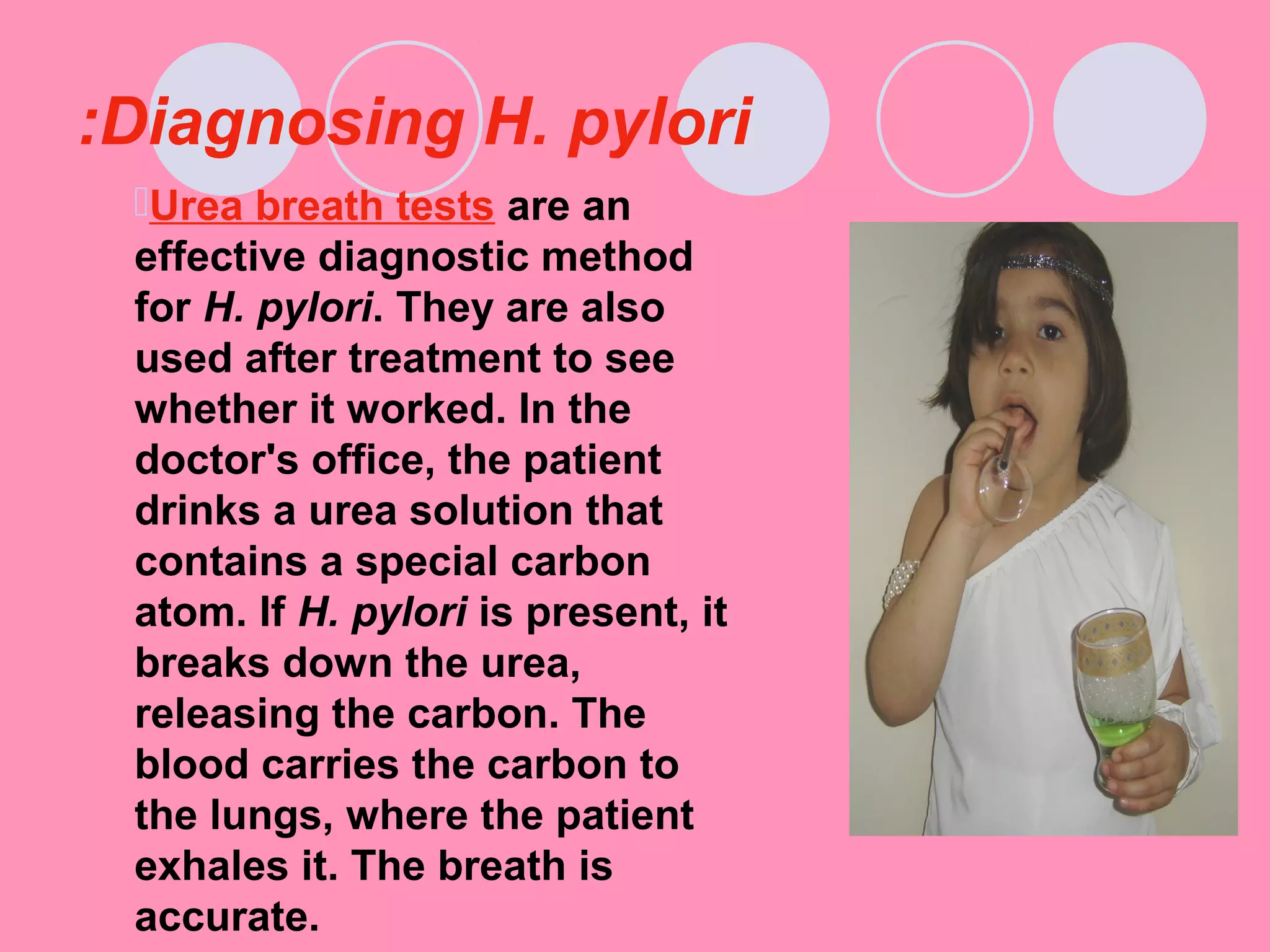 Diagnosing H. pylori:
Urea breath tests are an
effective diagnostic method
for H. pylori. They are also
used after treatment to see
whether it worked. In the
doctor's office, the patient
drinks a urea solution that
contains a special carbon
atom. If H. pylori is present, it
breaks down the urea,
releasing the carbon. The
blood carries the carbon to
the lungs, where the patient
exhales it. The breath is
accurate.
 
