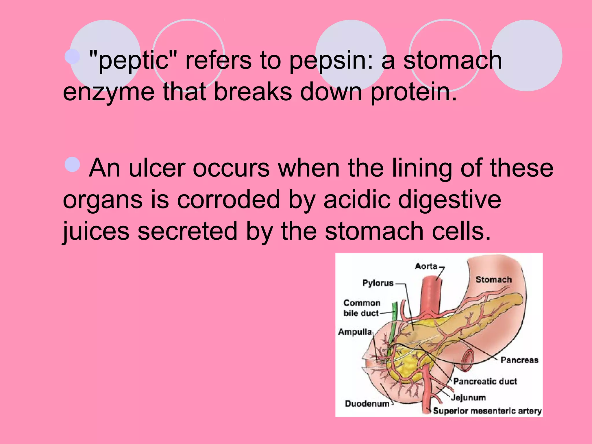 "peptic" refers to pepsin: a stomach
enzyme that breaks down protein.
An ulcer occurs when the lining of these
organs is corroded by acidic digestive
juices secreted by the stomach cells.
 