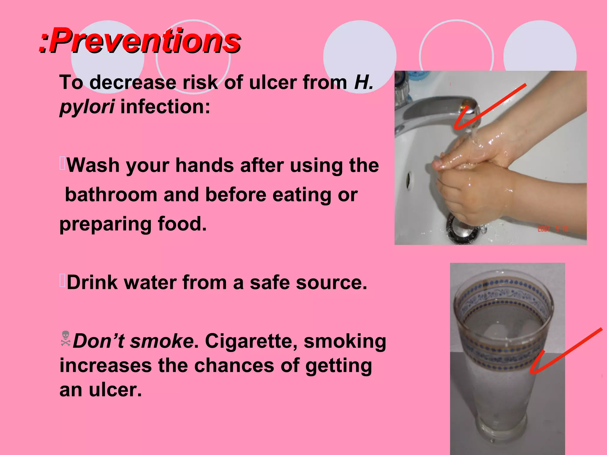 PreventionsPreventions::
To decrease risk of ulcer from H.
pylori infection:
Wash your hands after using the
bathroom and before eating or
preparing food.
Drink water from a safe source.
Don’t smoke. Cigarette, smoking
increases the chances of getting
an ulcer.
 