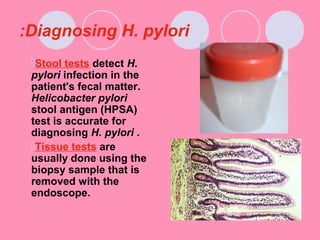 Diagnosing H. pylori:
Stool tests detect H.
pylori infection in the
patient's fecal matter.
Helicobacter pylori
stool antigen (HPSA)
test is accurate for
diagnosing H. pylori .
Tissue tests are
usually done using the
biopsy sample that is
removed with the
endoscope.
 