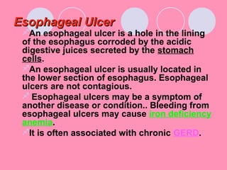 Esophageal UlcerEsophageal Ulcer
An esophageal ulcer is a hole in the lining
of the esophagus corroded by the acidic
digestive juices secreted by the stomach
cells.
An esophageal ulcer is usually located in
the lower section of esophagus. Esophageal
ulcers are not contagious.
 Esophageal ulcers may be a symptom of
another disease or condition.. Bleeding from
esophageal ulcers may cause iron deficiency
anemia.
It is often associated with chronic GERD.
 