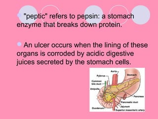 "peptic" refers to pepsin: a stomach
enzyme that breaks down protein.
An ulcer occurs when the lining of these
organs is corroded by acidic digestive
juices secreted by the stomach cells.
 