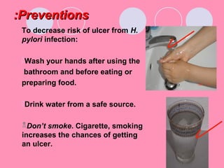 PreventionsPreventions::
To decrease risk of ulcer from H.
pylori infection:
Wash your hands after using the
bathroom and before eating or
preparing food.
Drink water from a safe source.
Don’t smoke. Cigarette, smoking
increases the chances of getting
an ulcer.
 