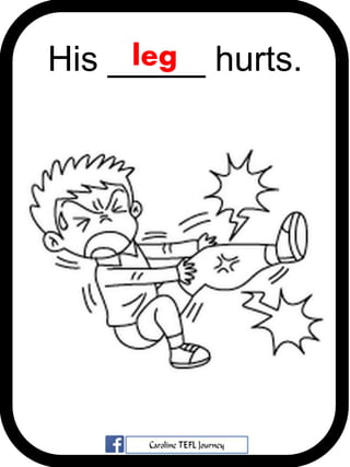 His _____ hurts.leg