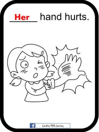 _____ hand hurts.Her
