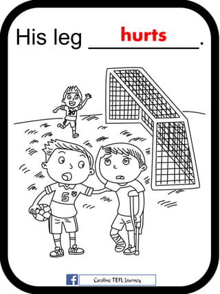 His leg _________.hurts