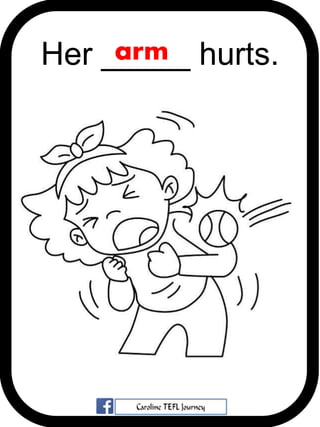 Her _____ hurts.arm
