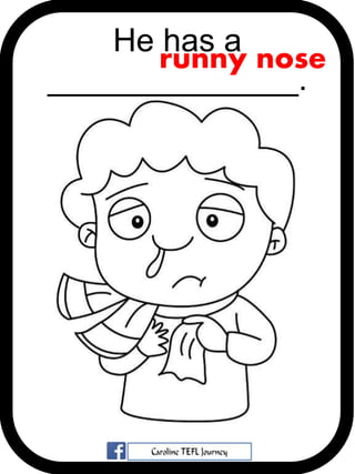 He has a
______________.
runny nose