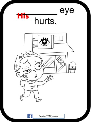________ eye
hurts.
His