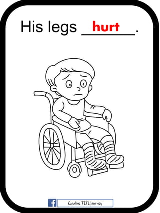 His legs ______.hurt